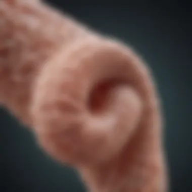 Natural Remedies for Tapeworms Natural remedies for treating tapeworm infection